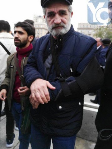 Xalq artistinin qolu sınıb Xalq artistinin qolu sınıb