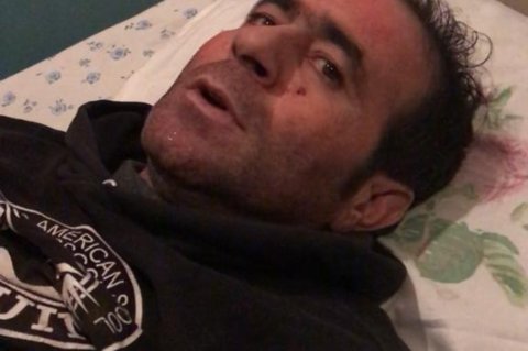 İranla sərhəddə atışma, yaralanan var İranla sərhəddə atışma, yaralanan var