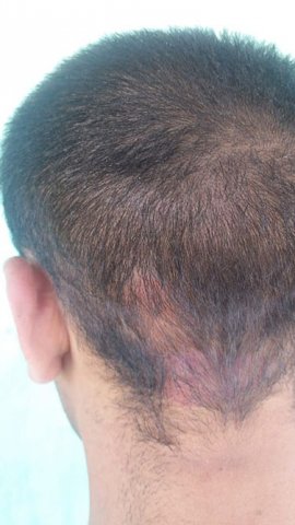 Ermənistanın hərbi qulluqçusu təmas xəttində saxlanıldı