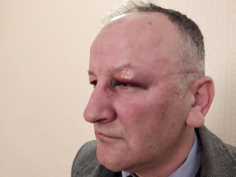Polislər müxalifətçi baş redaktoru döyüb Polislər müxalifətçi baş redaktoru döyüb