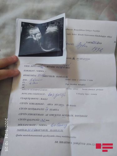 Bakıda yeni doğulan əkiz uşaqlardan birini oğurlayıblar? Bakıda yeni doğulan əkiz uşaqlardan birini oğurlayıblar?