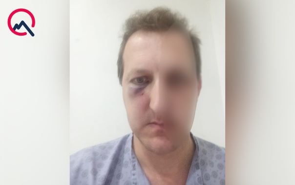 Bakıda Xalq artistinin oğlu döyülüb